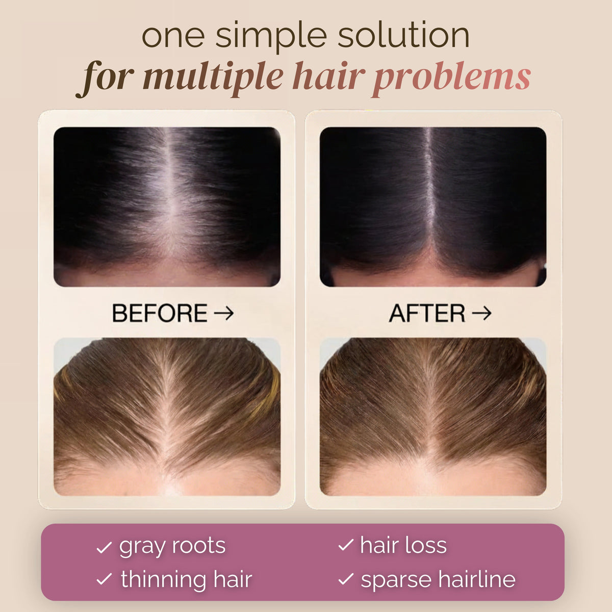 RootBlend™ Hair Concealer
