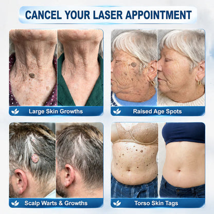 DermaRollix™ Skin Spot Removal Roller