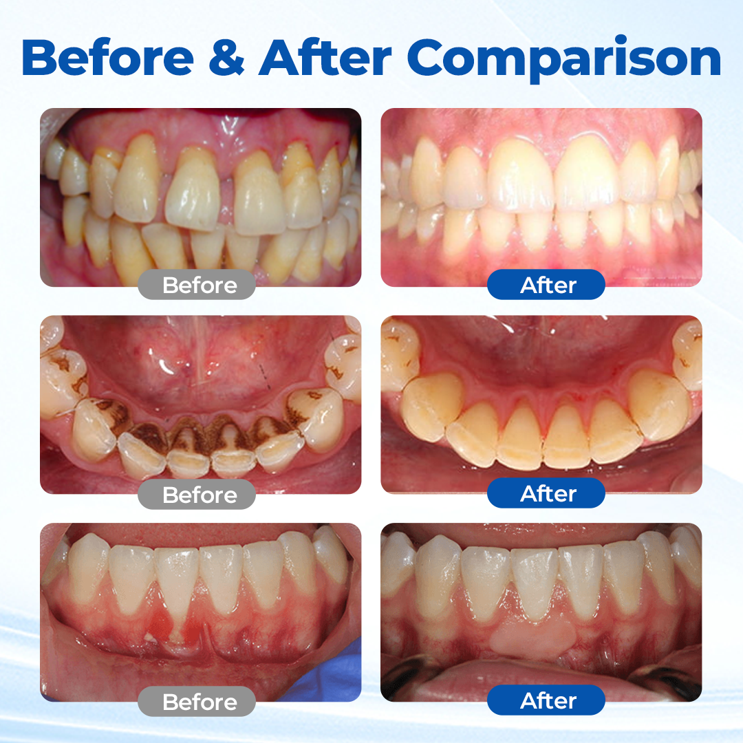 GumRevive™ Oral Microbiome Recovery Gel