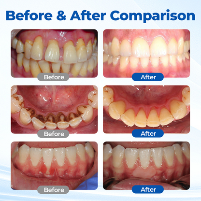 GumRevive™ Oral Microbiome Recovery Gel