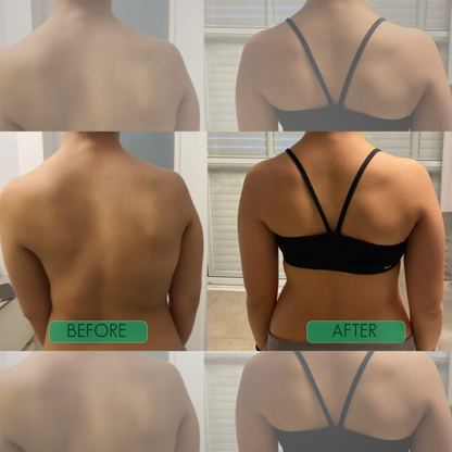 PostureAlign™ Adjustable Upper-Back Support Brace