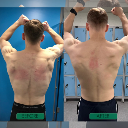 PostureAlign™ Adjustable Upper-Back Support Brace