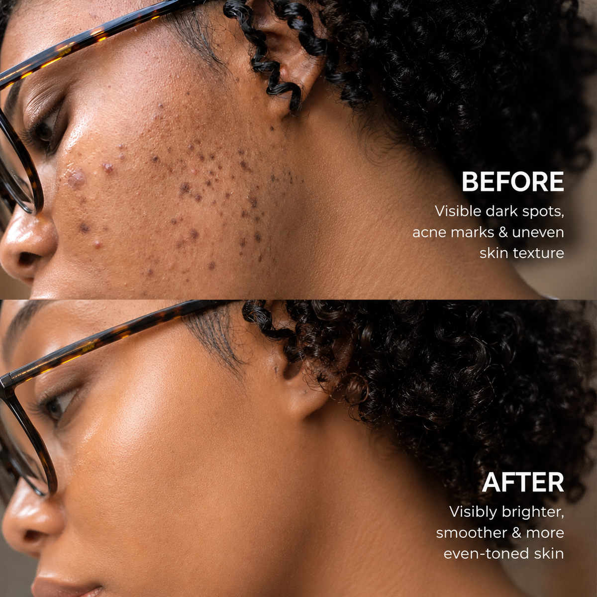 LumiClear™ Tranexamic Acid Brightening Cream