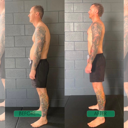 PostureAlign™ Adjustable Upper-Back Support Brace