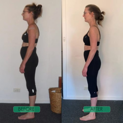 PostureAlign™ Adjustable Upper-Back Support Brace